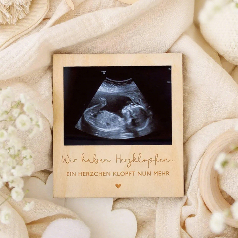 Ultrason Gebelik Duyuru Levhas - Baby Nursery Images incelemesi ve fiyatı